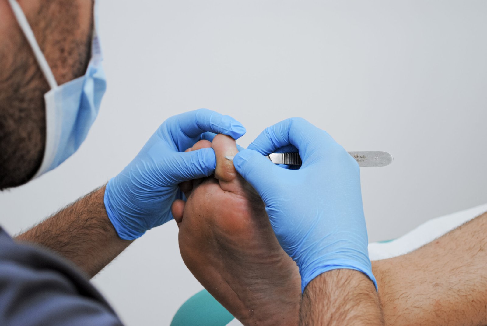 Podología en Torrent​